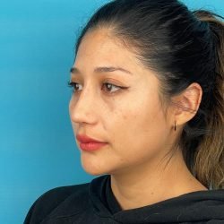 IMG_1193