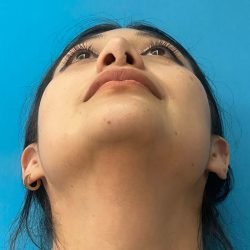 IMG_3728