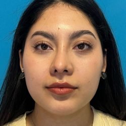 IMG_4743