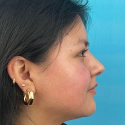 IMG_5764