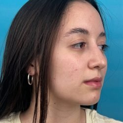 IMG_9203