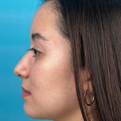 IMG_9204