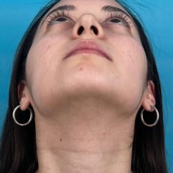 IMG_9206
