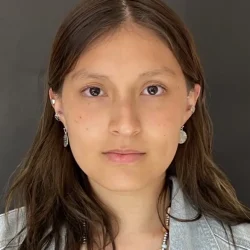 Resultados rinoplastia A Quito2