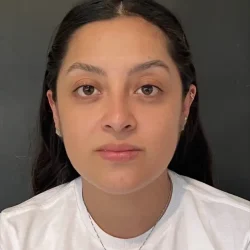 Resultados rinoplastia C Quito2