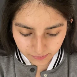 Resultados rinoplastia G Quito14