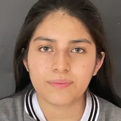 Resultados rinoplastia G Quito2