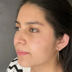 Resultados rinoplastia G Quito9