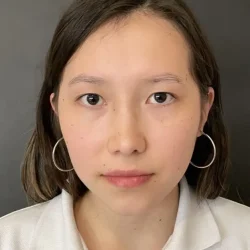 Resultados rinoplastia I Quito1