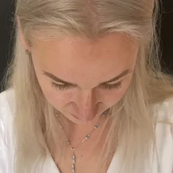 Resultados rinoplastia O Quito13