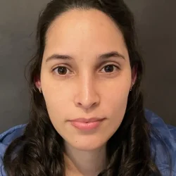 Resultados rinoplastia P Quito1