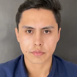Resultados rinoplastia Q Quito1