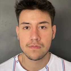 Resultados rinoplastia R Quito1