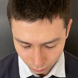 Resultados rinoplastia T Quito13