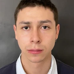 Resultados rinoplastia T Quito15