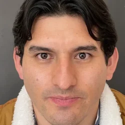 Resultados rinoplastia V Quito2