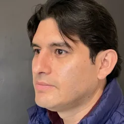 Resultados rinoplastia V Quito8