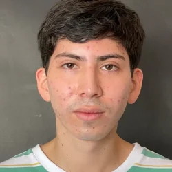 Resultados rinoplastia Z Quito1